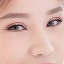 ศัลยกรรมตาสองชั้น