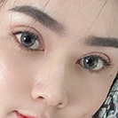 ปรับชั้นตา กลมโต