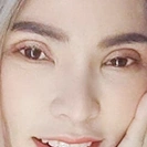 แก้ไขตาไม่เท่ากัน