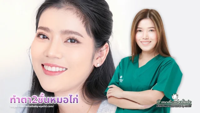 ทำตา2ชั้นหมอไก่