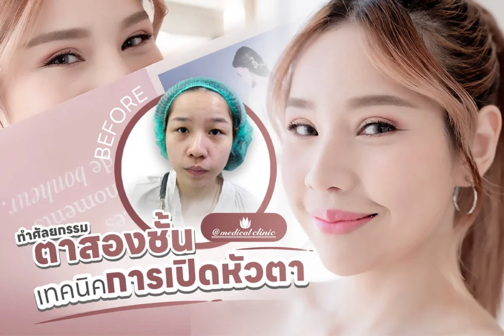 เปิดหัวตา