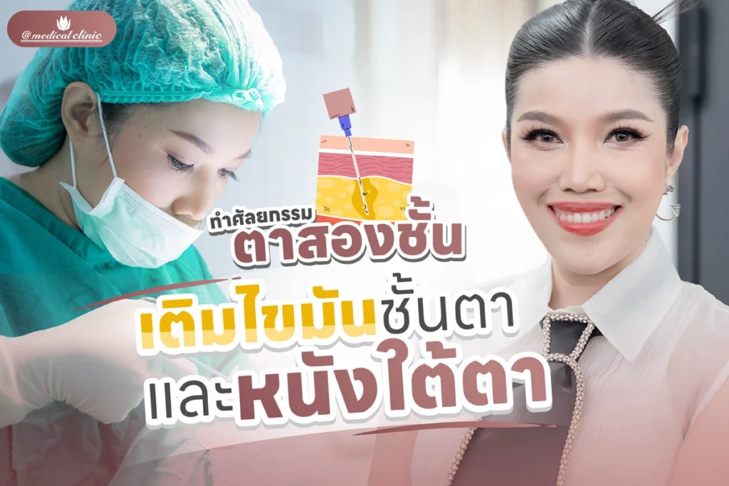 เติมไขมัน