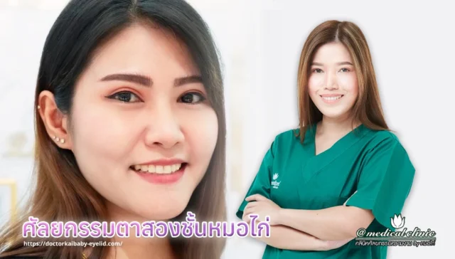 ศัลยกรรมตาสองชั้นหมอไก่