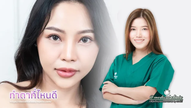 ทำตาที่ไหนดี