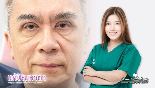 แก้ปัญหาตา