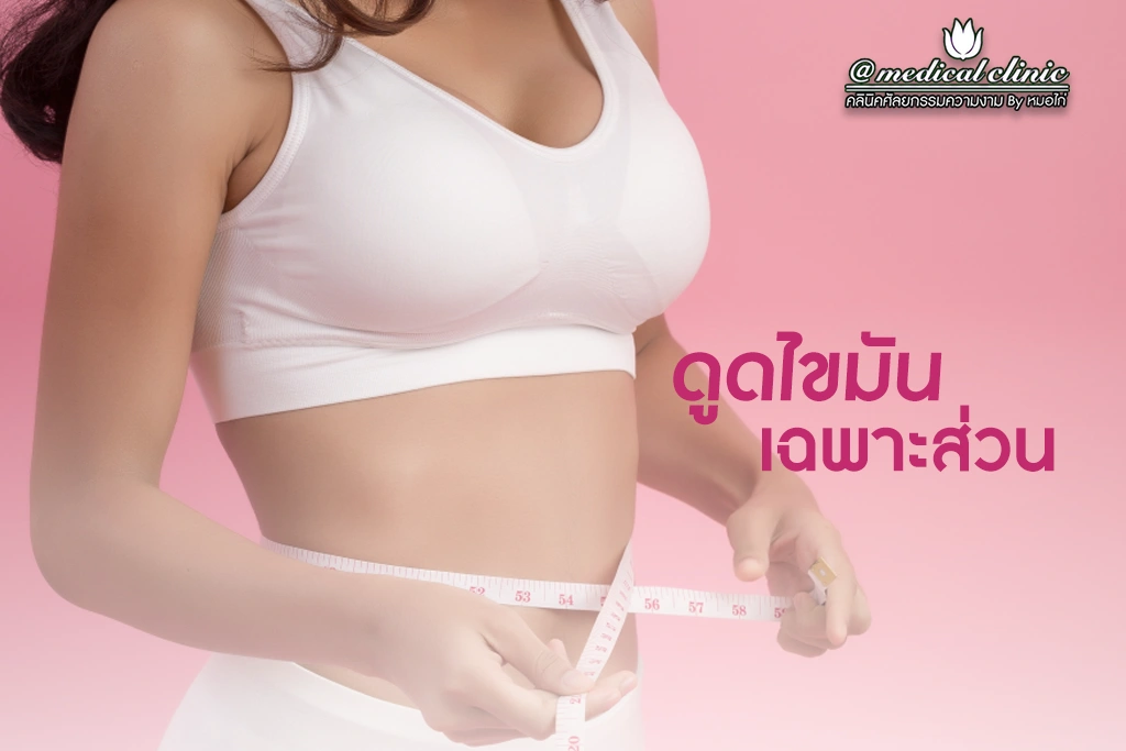 ดูดไขมันเฉพาะส่วน