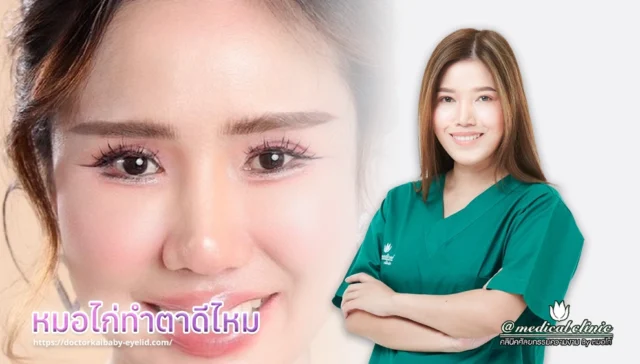 หมอไก่ทําตาดีไหม