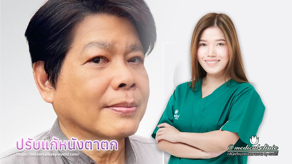 ปรับแก้หนังตาตก