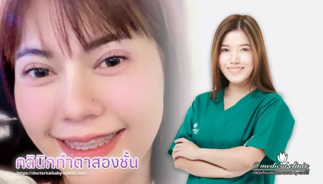 คลินิกทําตาสองชั้น