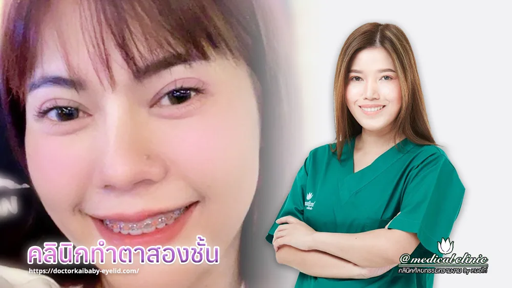 คลินิกทําตาสองชั้น