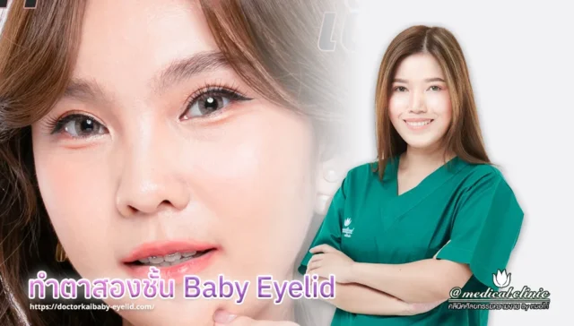 ทำตาสองชั้น Baby Eyelid